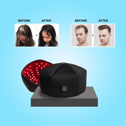Nexora™ - Laser Hair Growth System Cap