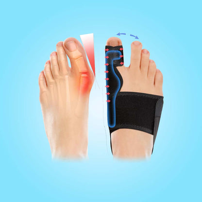 FlexiToe™️ - Orthopedic Bunion Corrector